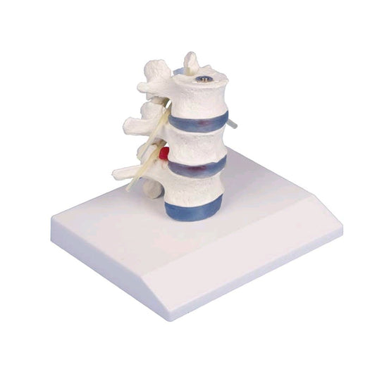 Modelos de columna vertebral