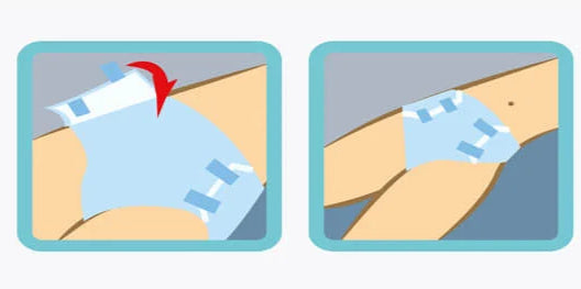 Cómo poner correctamente pañales para adultos