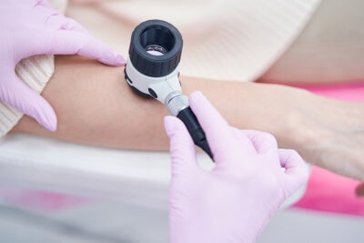 Un médecin utilise le dermatoscope pour examiner la peau